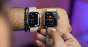 Future apple watch automatically tighten band